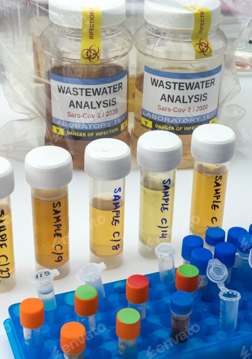 Preview: Wastewater samples, analysis of sars-cov-2 virus in patients infected by human coronavirus 229E