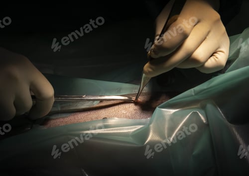 Preview: Closeup shot of doctors hands working on a surgery