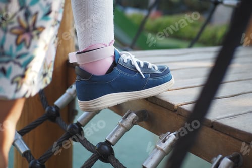 Preview: A little girl in orthosis shoes crosses a wooden bridge Child cerebral palsy disability.