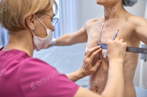Preview: Breast Augmentation. Closeup Beautician Hands Drawing Surgical Lines On Woman Breast. Female Body