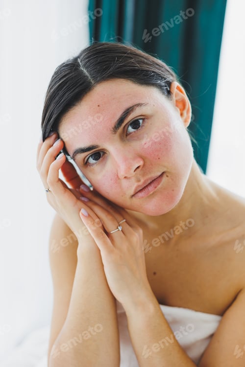 Preview: Close-up of a woman's face with redness. Mask on the face of your client in the beauty salon.