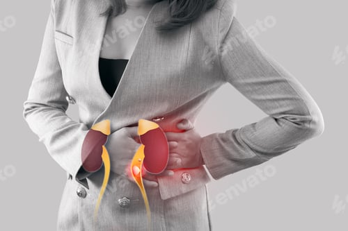 Preview: Stones in ureter