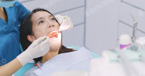 Preview: Doctor doing examination of the teeth to the patient