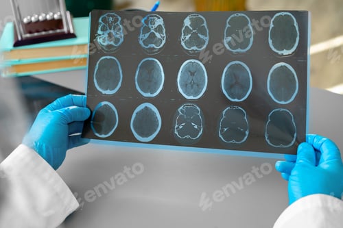 Preview: Man doctor examining head mri while sitting at the table in hospital