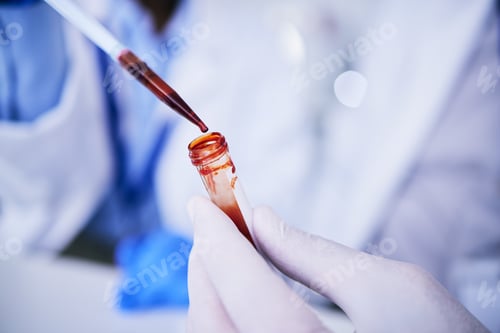 Preview: Hands, pipette and scientist with blood test tube for research in laboratory. Science, medical prof