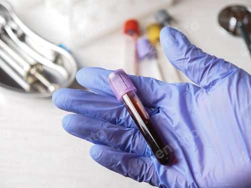 Preview: Hand in medical glove holding a test tube