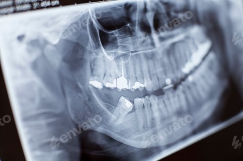 Preview: X-ray Close-up