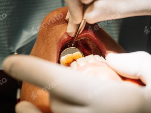 Preview: Dentist opens the mouth of his patient and begins to revise the interior helped by his instruments.