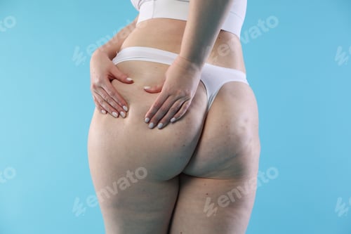 Preview: Woman with cellulite on light blue background, closeup