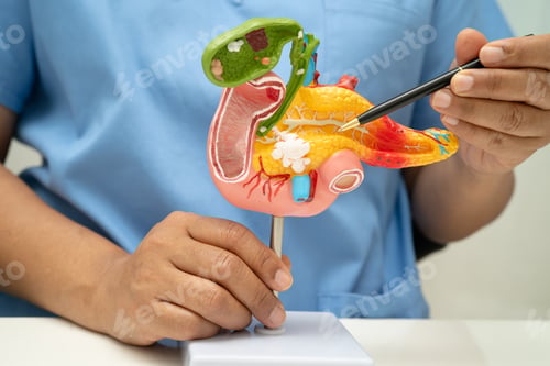 Preview: Pancreatitis, pancreatic cancer, Asian doctor with pancreas, gallbladder