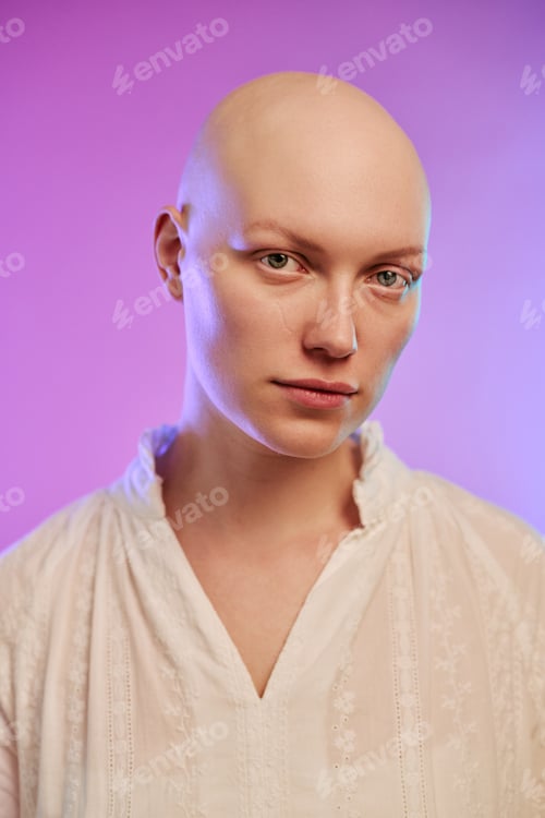 Preview: Portrait of Young Adult Woman Experiencing Alopecia Looking Confident