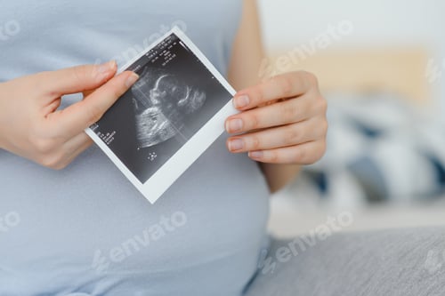 Preview: pregnant woman holding ultrasound scan on her belly