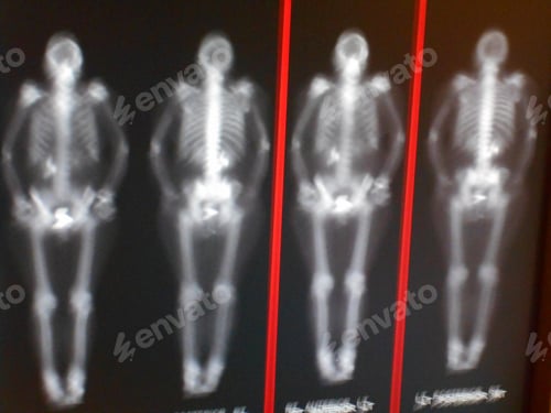 Preview: Radioactive Scans