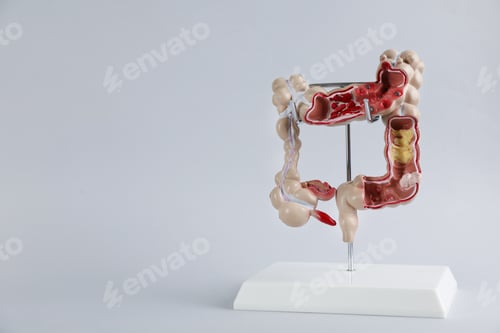 Preview: Human colon model on light grey background. Space for text
