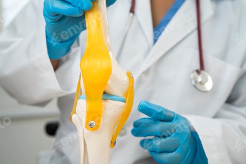 Preview: Osteoarthritis of the knee, Doctor holding human knee joint orthopedic