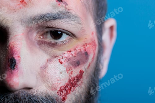 Preview: Close up shot of black eye and scars on injured man face, studio background