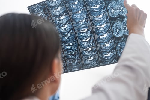 Preview: close up doctor analyzes patient X-ray films mri tomography scans holding in hands