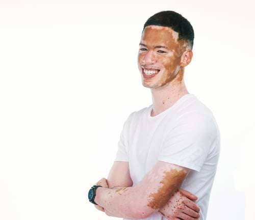 Preview: My skin doesnt define me