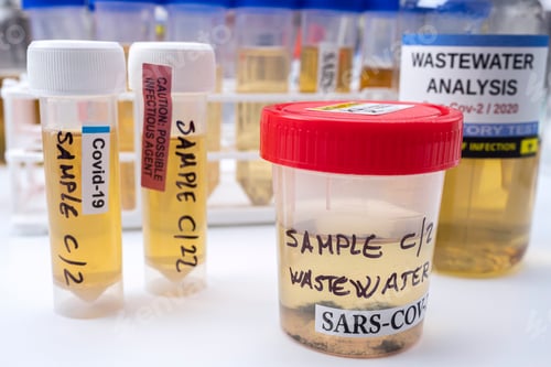Preview: Investigation of sars-cov-2 virus in humans in a wastewater laboratory, conceptual image