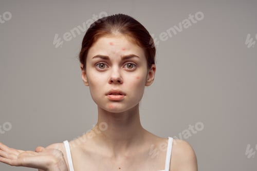 Preview: beautiful woman facial skin problems dermatology light background