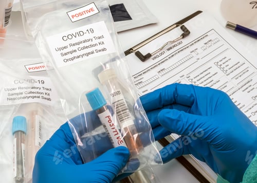 Preview: Nurse comparing positive covid-19 test results of infected persons, Conceptual image