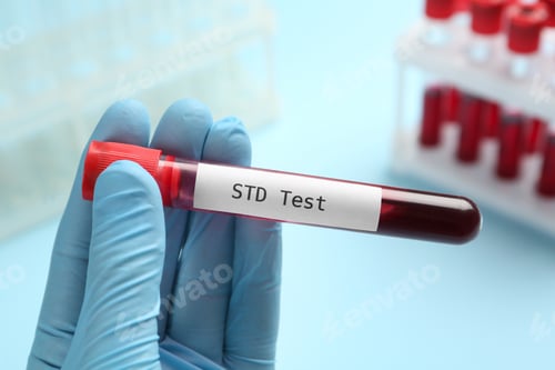Preview: Scientist holding tube with blood sample and label STD Test on light blue background, closeup
