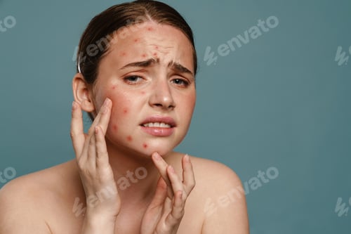Preview: Ginger shirtless woman frowning and squeezing pimple on her face
