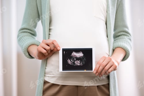 Preview: Partial view of pregnant woman holding ultrasound scan of baby in hands