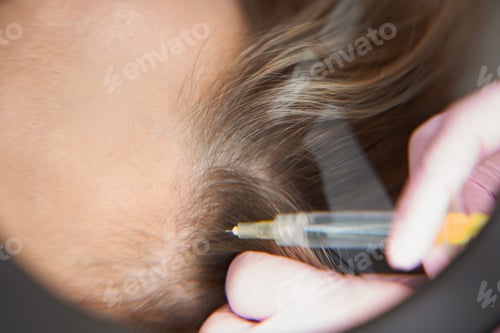 Preview: Female client on an effective anti-aging injection procedure