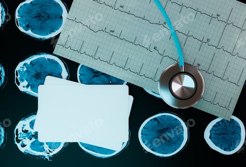 Preview: business card on CT scane film and EKG chart with stethoscopes