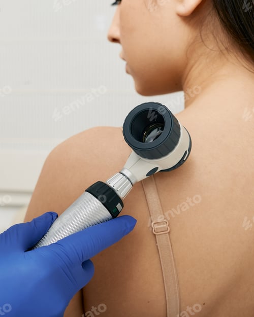 Preview: Mole dermoscopy. Physician check-up of a patient's skin with a dermatoscopy for prevention of
