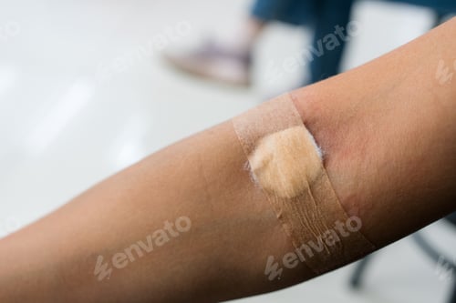 Preview: Plaster and cotton on woman arm after blood testing or blood donation