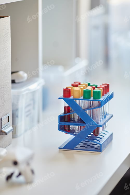 Preview: Test Tubes with Blood or Chemicals on Scientists Workstation In Laboratory