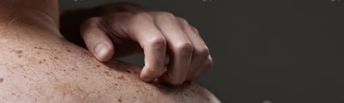 Preview: Man Scratching Shoulder Showing Skin Condition Concern