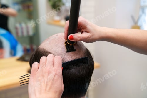 Preview: Precise Hair Trimming for Prosthesis Integration at Hair Clinic