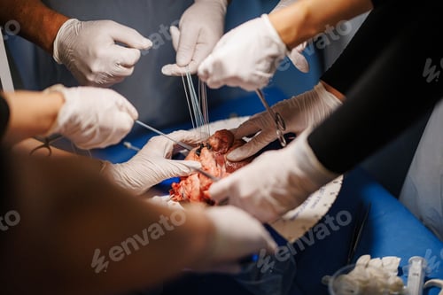 Preview: Surgeons performing a complex operation.