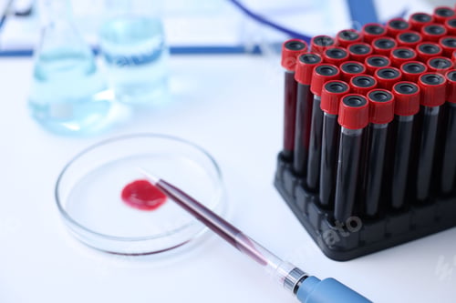 Preview: Dripping blood sample onto Petri dish on white table in laboratory, closeup