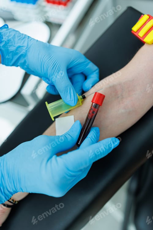 Preview: A nurse doctor collects blood from a patient's vein. Taking blood from a woman for research.