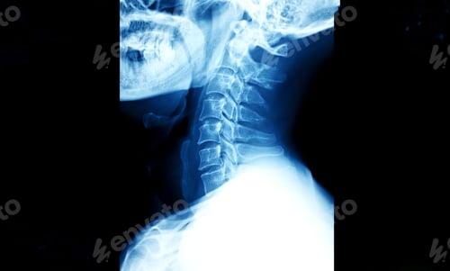 Preview: X-ray image of human neck