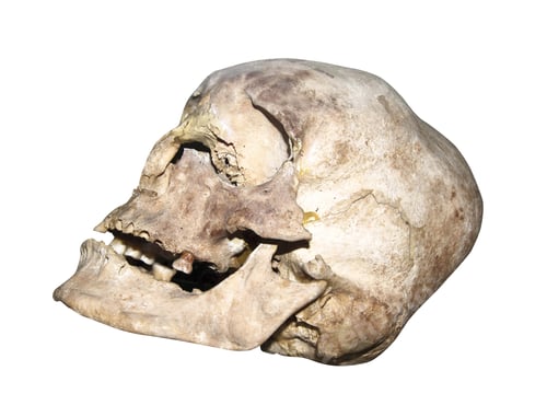 Preview: old human skull