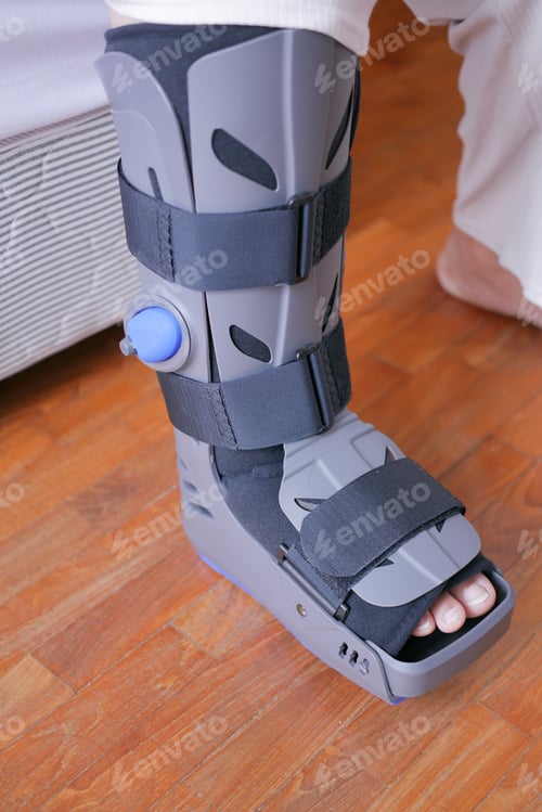 Preview: women broken feet with a grey plastic boot ankle brace injury protecting boot