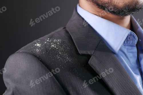 Preview: men with dandruff on his shirt