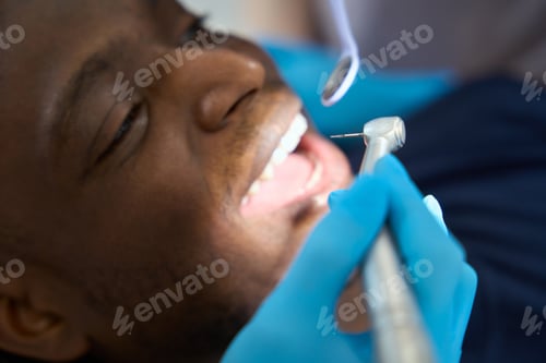 Preview: Close-up stomatologist using dental drill to clean out nerves