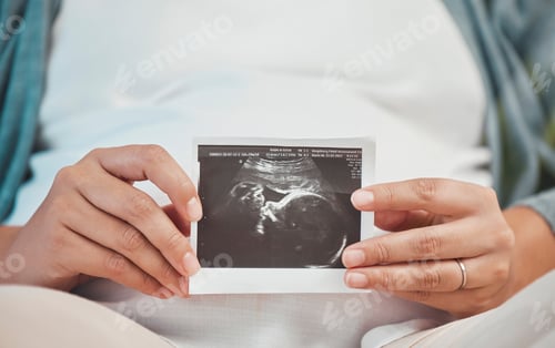 Preview: Pregnancy, love and hands with scan of baby with woman excited for future with family, children and