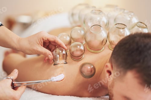 Preview: A picture of a man having cupping therapy