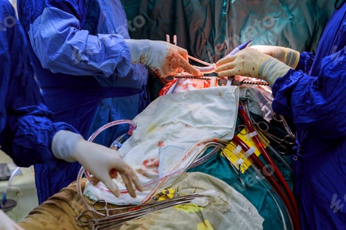 Preview: Closeup of doctor's hand in gloves in the blood holds the forceps during the operation.