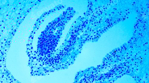 Preview: Lillium 0vary