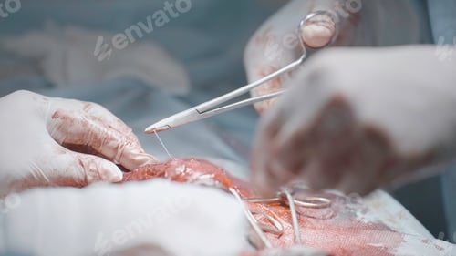 Preview: Surgeons cutting flesh. Action. Close-up of surgical intervention in male genital organ. Bloody