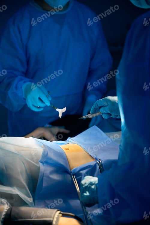 Preview: Surgeons doing surgery to patient in hospital operating theater