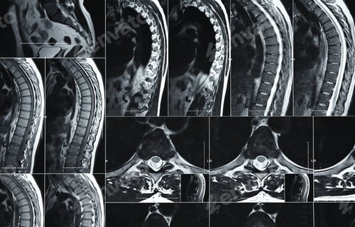 Preview: MRI or CT scan of human lumbar spine